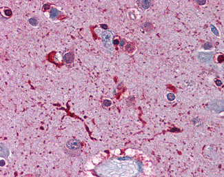 Ferritin Light Chain Antibody in Immunohistochemistry (Paraffin) (IHC (P))