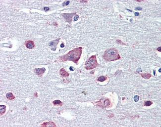 GABRA4 Antibody in Immunohistochemistry (Paraffin) (IHC (P))