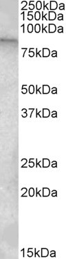 TRPC4AP Antibody in Western Blot (WB)