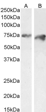 PCSK9 Antibody in Western Blot (WB)