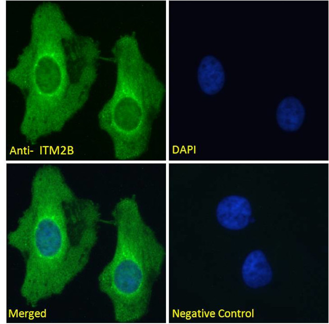 ITM2B Antibody in Immunocytochemistry (ICC/IF)