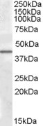CAMK1D Antibody in Western Blot (WB)