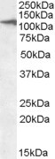 CLEC16A Antibody in Western Blot (WB)