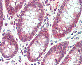 SH2D3A Antibody in Immunohistochemistry (Paraffin) (IHC (P))