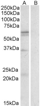 SLC7A5 Antibody in Western Blot (WB)