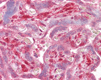 DLX5 Antibody in Immunohistochemistry (Paraffin) (IHC (P))