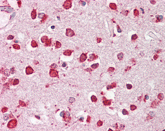 LIMP2 Antibody in Immunohistochemistry (Paraffin) (IHC (P))