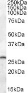 PSPH Antibody in Western Blot (WB)