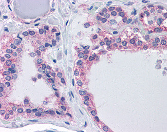 CENTG1 Antibody in Immunohistochemistry (Paraffin) (IHC (P))