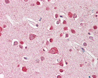 STK39 Antibody in Immunohistochemistry (Paraffin) (IHC (P))