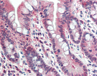 PSMB10 Antibody in Immunohistochemistry (Paraffin) (IHC (P))