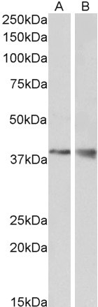 WNT9B Antibody in Western Blot (WB)