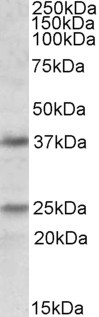 Podoplanin Antibody in Western Blot (WB)