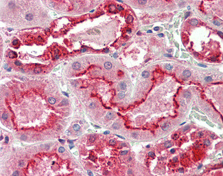 GGCX Antibody in Immunohistochemistry (Paraffin) (IHC (P))