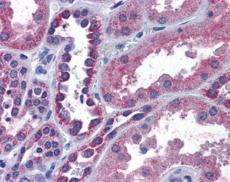 IREB2 Antibody in Immunohistochemistry (Paraffin) (IHC (P))