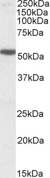 HTR3B Antibody in Western Blot (WB)