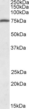 Kindlin 3 Antibody in Western Blot (WB)