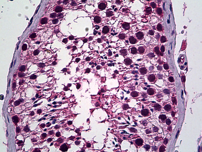 PREX1 Antibody in Immunohistochemistry (Paraffin) (IHC (P))