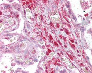 Calponin 2 Antibody in Immunohistochemistry (Paraffin) (IHC (P))