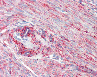 PRKCDBP Antibody in Immunohistochemistry (Paraffin) (IHC (P))