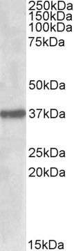 SUMF1 Antibody in Western Blot (WB)