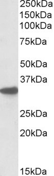 CYB5R3 Antibody in Western Blot (WB)