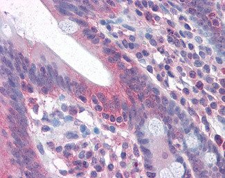 FAS Antibody in Immunohistochemistry (Paraffin) (IHC (P))