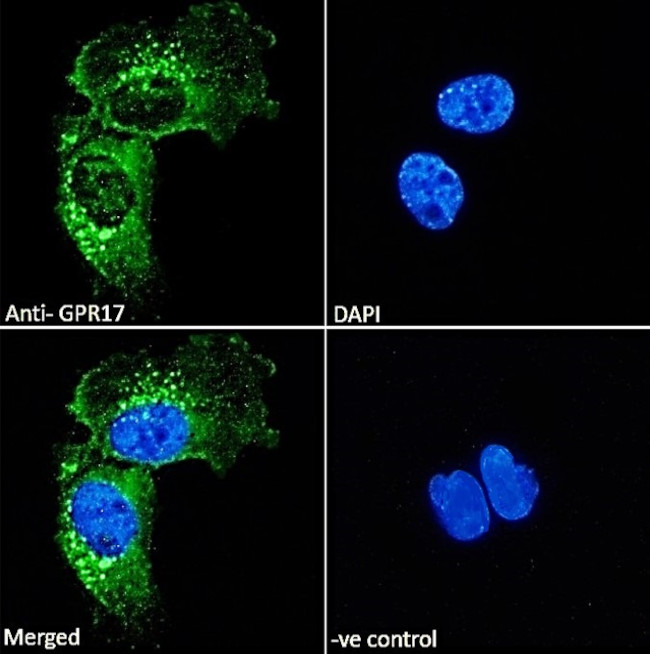 GPR17 Antibody in Immunocytochemistry (ICC/IF)