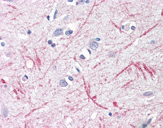 DTX3 Antibody in Immunohistochemistry (Paraffin) (IHC (P))