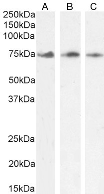 KLHL6 Antibody in Western Blot (WB)
