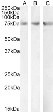CPT2 Antibody in Western Blot (WB)