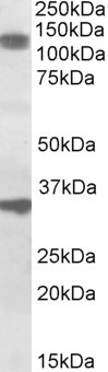 CCAR1 Antibody in Western Blot (WB)