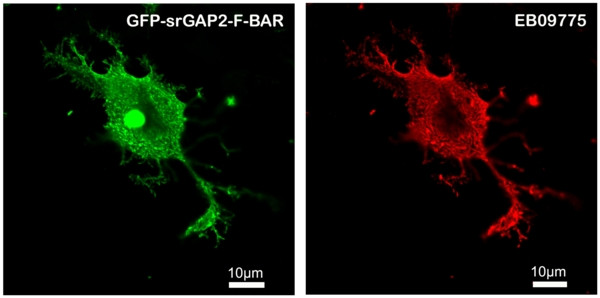 SRGAP2 Antibody in Immunocytochemistry (ICC/IF)