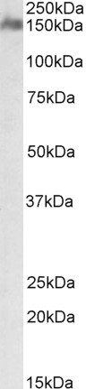 CSMD1 Antibody in Western Blot (WB)
