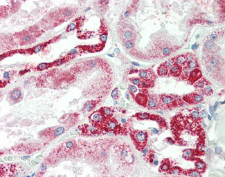NDUFS6 Antibody in Immunohistochemistry (Paraffin) (IHC (P))