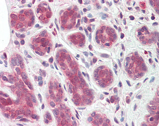TIPRL Antibody in Immunohistochemistry (Paraffin) (IHC (P))