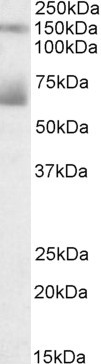 Mesothelin Antibody in Western Blot (WB)