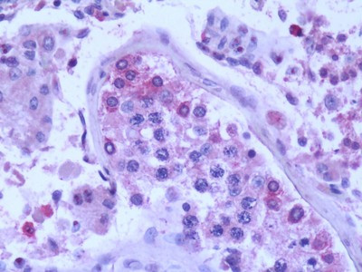 DYDC1 Antibody in Immunohistochemistry (Paraffin) (IHC (P))
