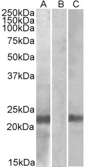 Cystatin 8 Antibody in Western Blot (WB)