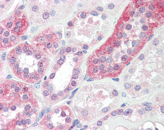 MON1A Antibody in Immunohistochemistry (Paraffin) (IHC (P))
