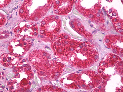 CHCHD3 Antibody in Immunohistochemistry (Paraffin) (IHC (P))