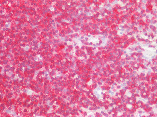 LSP1 Antibody in Immunohistochemistry (Paraffin) (IHC (P))