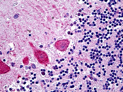 TRIM71 Antibody in Immunohistochemistry (Paraffin) (IHC (P))