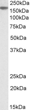 EVI1 Antibody in Western Blot (WB)