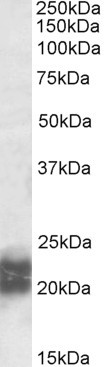 NPC2 Antibody in Western Blot (WB)