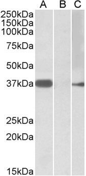 MYF6 Antibody in Western Blot (WB)
