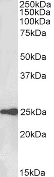 WFDC2 Antibody in Western Blot (WB)