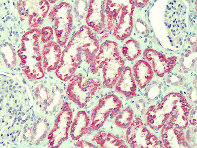 CMG2 Antibody in Immunohistochemistry (Paraffin) (IHC (P))