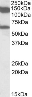 MLLT10 Antibody in Western Blot (WB)