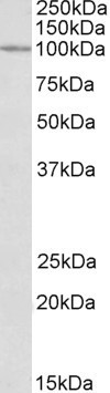 CLCN2 Antibody in Western Blot (WB)